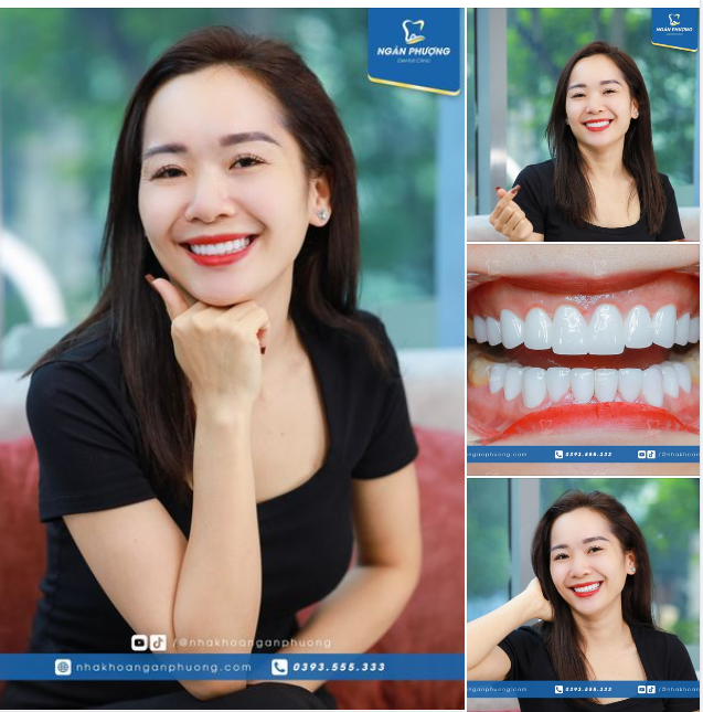 Nụ cười rạng rỡ của chị Thoa trong ngày tái khám cuối tuần