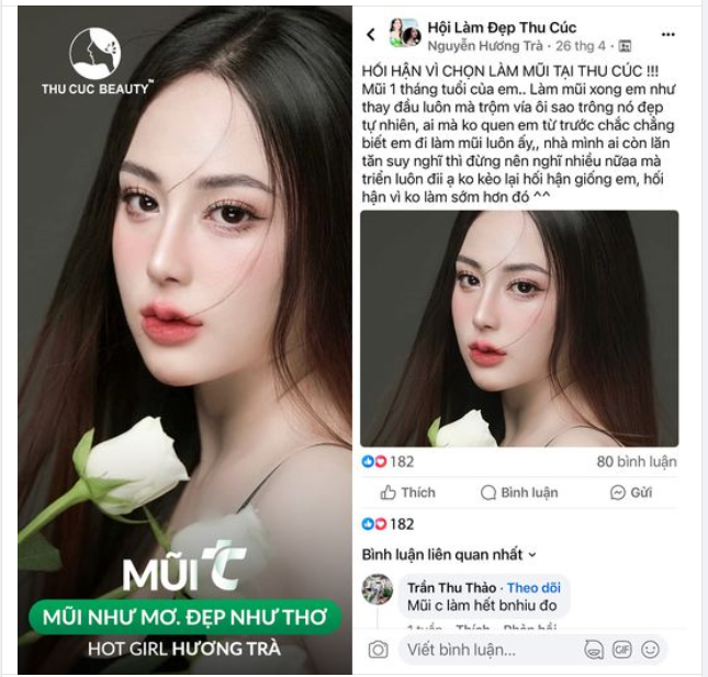 Mũi đẹp như mơ đẹp như thơ