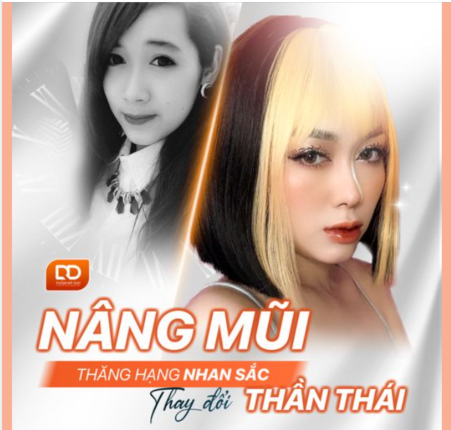 Nâng mũi - Thăng hạng nhan sắc - Thay đổi thần thái.