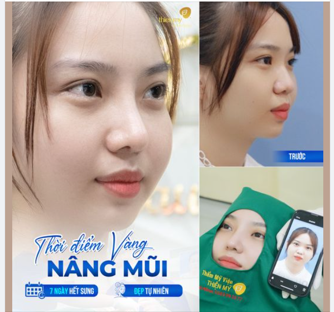 Thiện Mỹ là điểm đến lý tưởng cho những ai đang tìm kiếm sự tự tin và vẻ đẹp tự nhiên thông qua dịch vụ thẩm mỹ.
