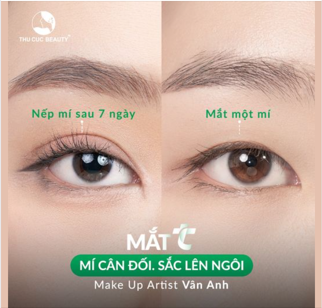 Mí đẹp tự nhiên sau 7 ngày