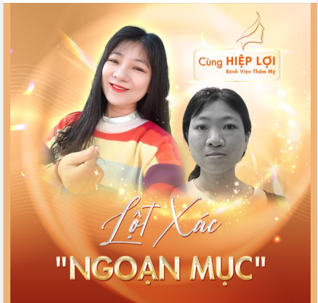 Ca phẩu thuật mang đến kết quả "Lột xác ngoạn mục"