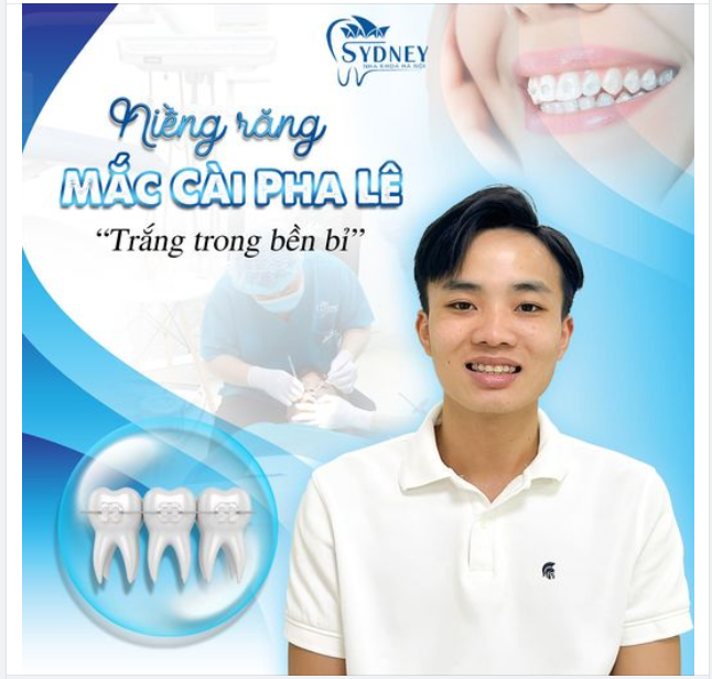 NIỀNG RĂNG MẮC CÀI PHA LÊ - TRẮNG TRONG BỀN BỈ