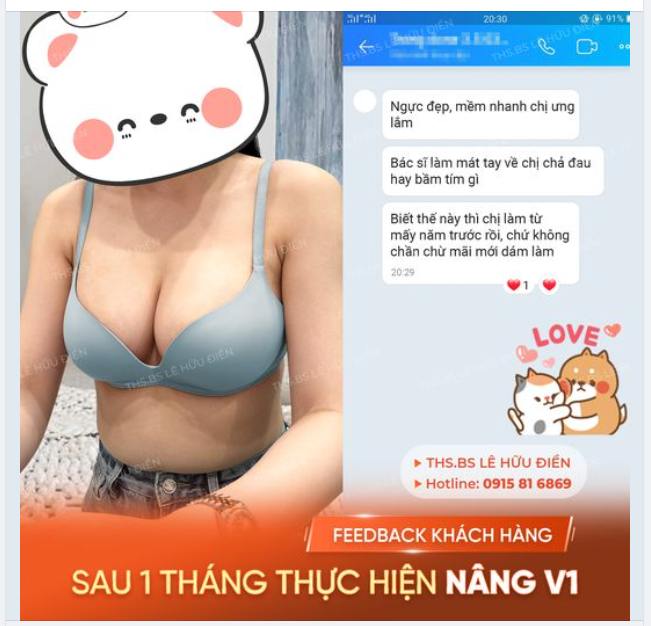 Chị khách nhà DrD tâm sự: "Biết đẹp mà không đau thế này chị đã làm từ mấy năm trước rồi".