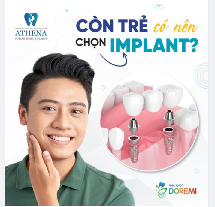 CÒN TRẺ CÓ NÊN CHỌN IMPLANT!
