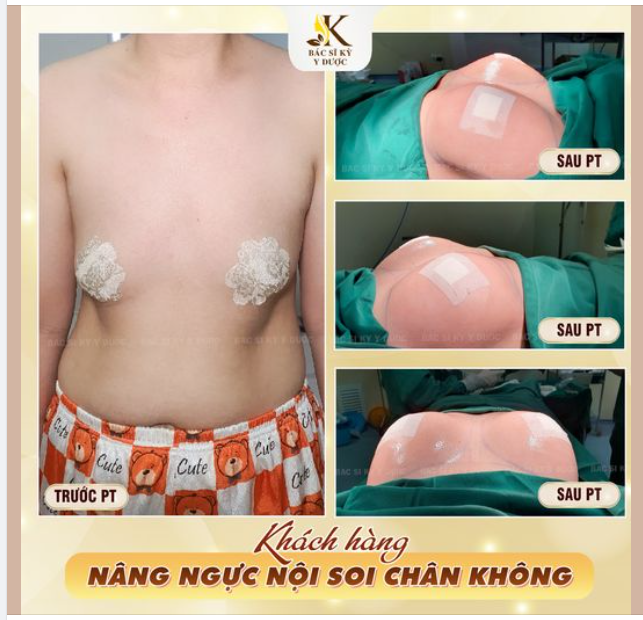 MUỐN CÓ VÒNG 1 ĐẸP THÌ NHẤT ĐỊNH KHÔNG ĐƯỢC BỎ QUA BÀI VIẾT NÀY