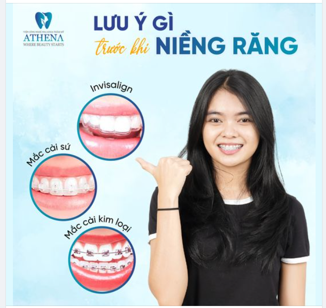 6 LƯU Ý QUAN TRỌNG NÊN ĐỌC NGAY TRƯỚC KHI NIỀNG RĂNG