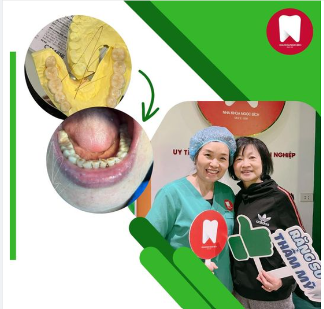TẠI SAO KHÁCH HÀNG TRUNG NIÊN LẠI TIN TƯỞNG CHỌN NHA KHOA NGỌC BÍCH LÀM RĂNG SỨ