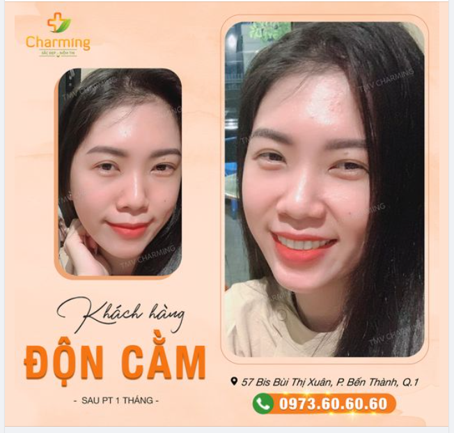 Nàng khách của Charming trông thật tự tin sau khi độn cằm.