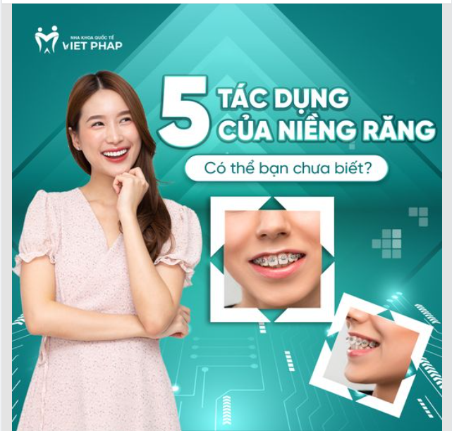 5 TÁC DỤNG CỦA NIỀNG RĂNG, CÓ THỂ BẠN CHƯA BIẾT?