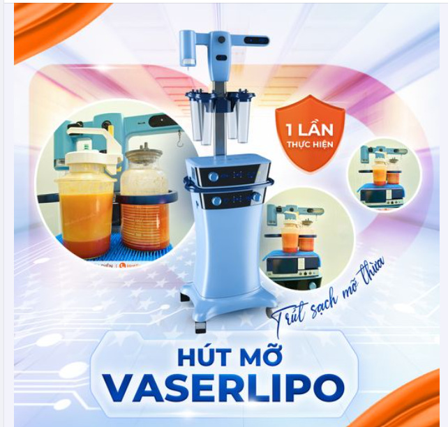 HÚT MỠ VASERLIPO - 90 PHÚT, TRÚT SẠCH MỠ THỪA
