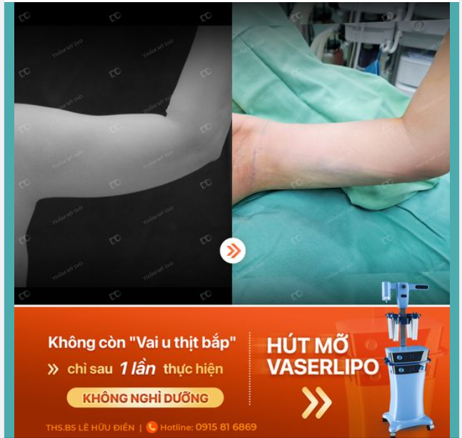 ĐIỂM DANH NHỮNG CÔ NÀNG "CÁNH TAY LỰC ĐIỀN, VAI U THỊT BẮP"