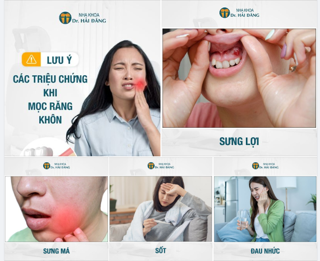 Tưng bừng mừng sinh nhật 5 tuổi, nha khoa Hải Đăng tặng ưu đãi cực sốc, cmt hoặc để lại SĐT ngay!