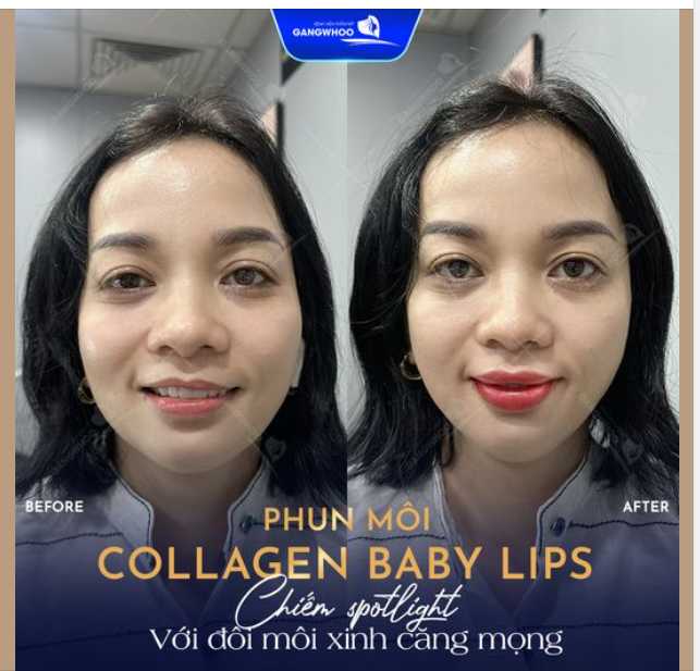 PHUN MÔI COLLAGEN BABY LIPS