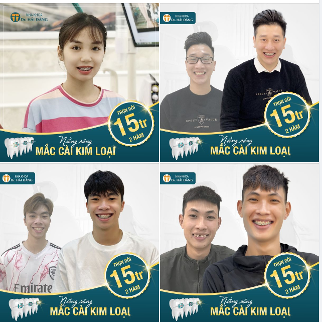 Đặc biệt, trong tháng vàng mừng sinh nhật tròn 5 tuổi, nha khoa Hải Đăng tặng bạn ưu đãi cực yêu thương!