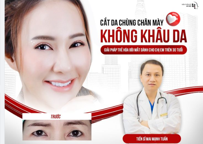 CẮT DA CHÙNG CHÂN MÀY KHÔNG KHÂU DA