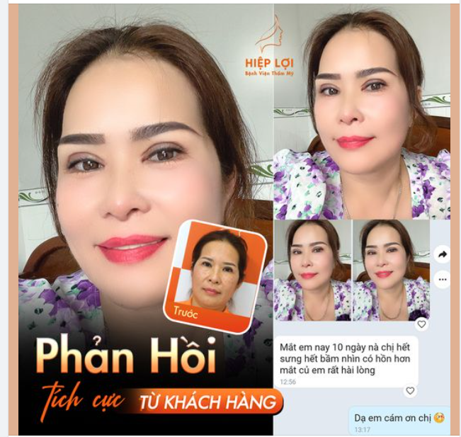 Feedback "tích cực" sau 10 ngày của chị khách