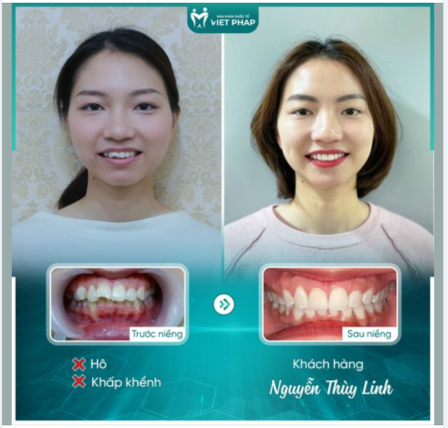 NỖ LỰC ĐẾN CUỐI CHẶNG ĐƯỜNG ĐỂ NHẬN LẠI KẾT QUẢ XỨNG ĐÁNG