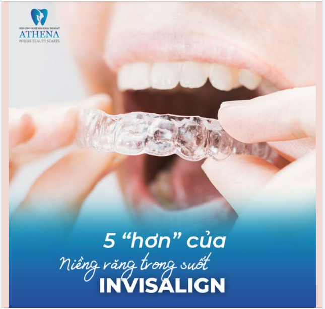 Invisalign tự hào là công nghệ niềng răng trong suốt hiện đại nhất, đã mang lại nụ cười mong đợi cho hơn 14 triệu người trên toàn thế giới.