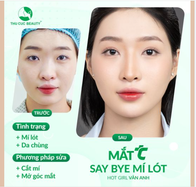Ngày xưa chê mắt em xấu! Giờ anh hối hận chưa?