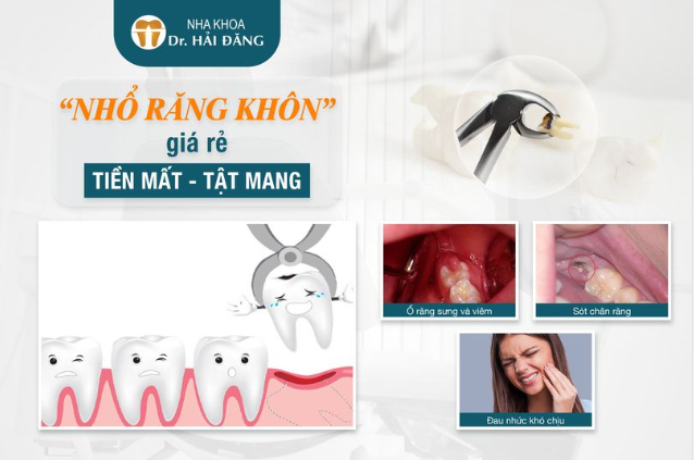 Nhiều người vẫn nghĩ rằng, nhổ răng khôn thì chỉ cần đến cơ sở y tế nào cũng được.