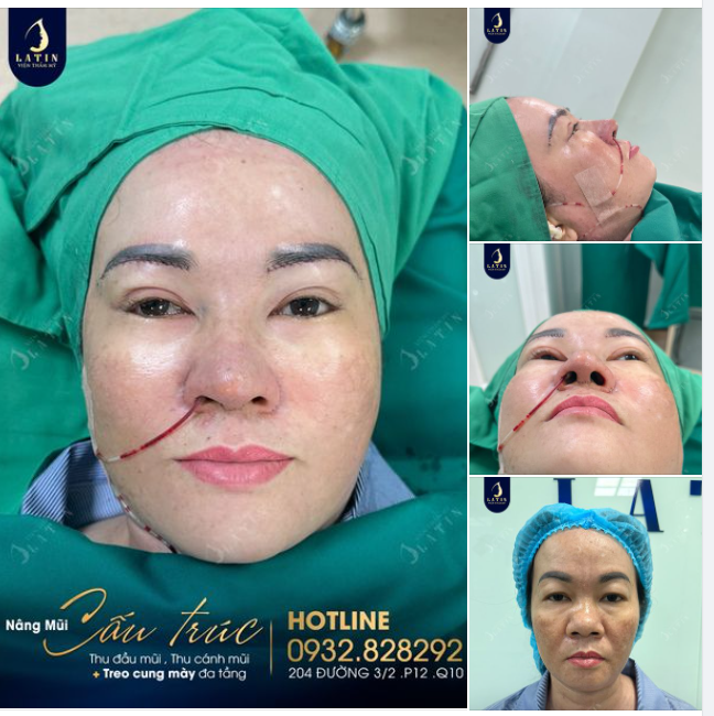 Phụ nữ ở độ tuổi nào cũng có quyền LÀM ĐẸP. Hoàn thành combo cho chị gái đến từ Cà Mau: