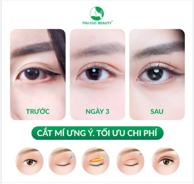 Phương pháp làm đẹp tạm biệt miếng dán mí, kích mí mỗi ngày mà chị em nên biết