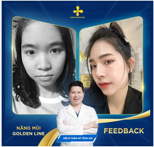 "Chủ tịch Đào Minh Châu bảo bọn em làm ở đây rất là tin tưởng luôn" - lời chia sẻ này của Thanh Ngọc giống như lời chứng nhận cho tay nghề của Tiến sĩ Thẩm mỹ Tống Hải.