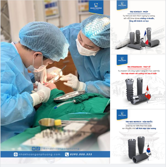 Trồng Implant ở Ngân Phượng được bảo hành như thế nào?