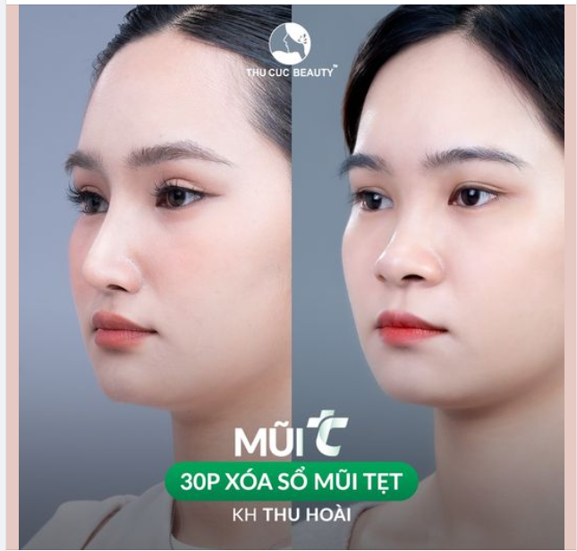 Chia tay sống mũi tẹt sau 30P cùng Mũi TC