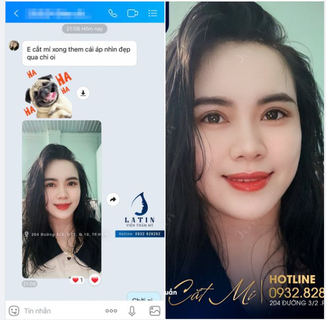 Chị gái thích mí to tròn như Ngọc Trinh và cái kết