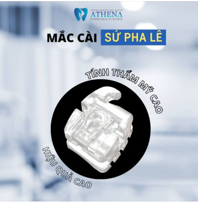 NIỀNG RĂNG MẮC CÀI SỨ - HIỆU QUẢ VÀ THẨM MỸ CAO
