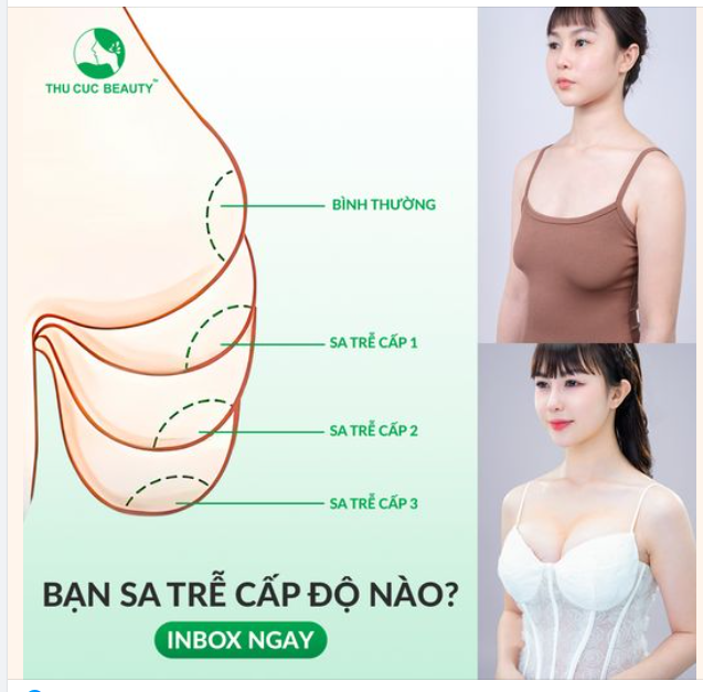 Ưu đãi Ngực TC treo sa trễ -30% duy nhất trong tháng 6 này