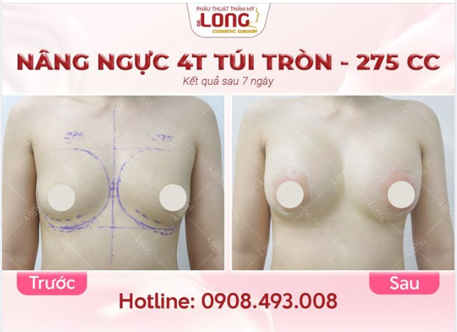 VÒNG 1 SAU KHI NÂNG ĐƯỢC 7 NGÀY SẼ NHƯ THẾ NÀO?