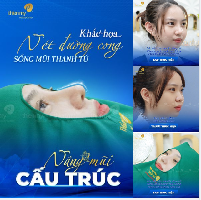 EM SINH EM ĐẸP VÀ LUNG LINH