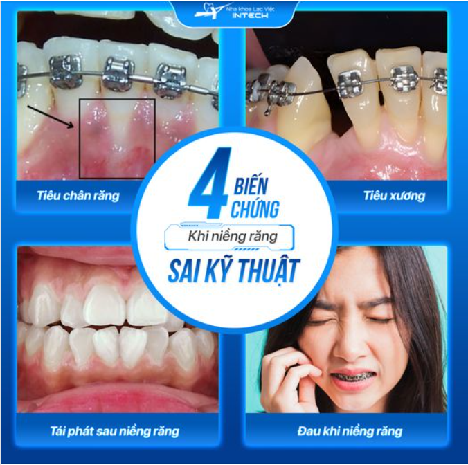 KHÔNG PHẢI CÂU CHUYỆN NIỀNG RĂNG NÀO CŨNG NHẬN "CÁI KẾT ĐẸP"