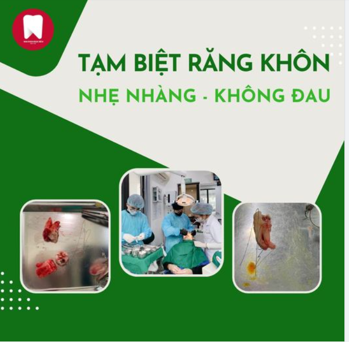 NHỔ RĂNG KHÔN KHÔNG ĐAU LÀ CÓ THẬT