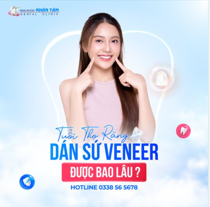 Tuổi thọ răng dán sứ veneer được bao lâu?