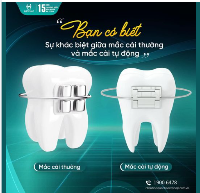 PHÂN BIỆT MẮC CÀI KIM LOẠI THƯỜNG VÀ TỰ ĐỘNG