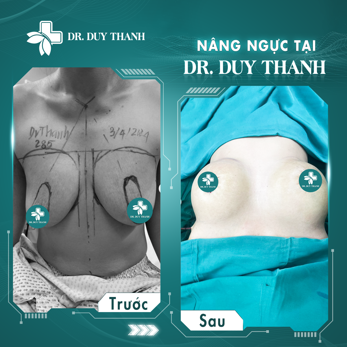Dr Duy Thanh cứu cánh các chị em sa trễ sau sinh
