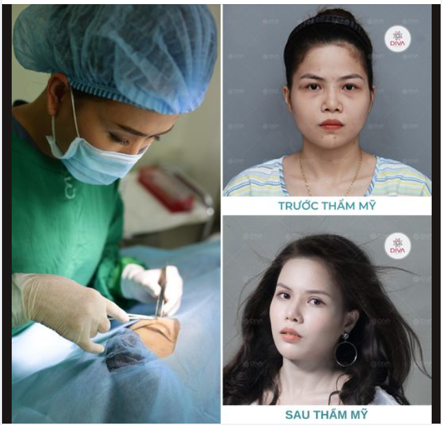 Sau 7 dịch vụ, cô gái đã có thể rạng rỡ, xinh đẹp trẻ trung đúng tuổi