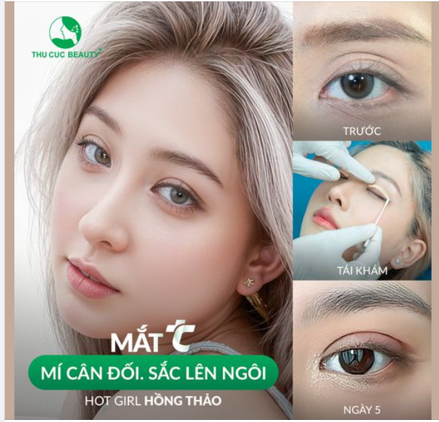Chỉ một chi tiết nhỏ. Thay đổi cả khuôn mặt?