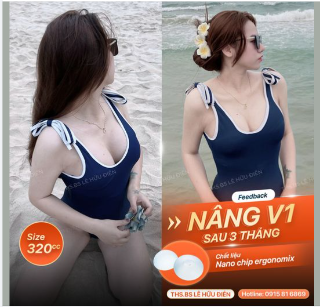 V1 CĂNG TRÀN - KHE SÂU "BỎNG MẮT"