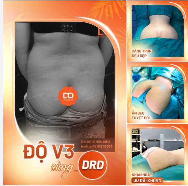 ĐỘ V3 CĂNG TRÒN TỰ TIN CHÀO HÈ CÙNG DRD.