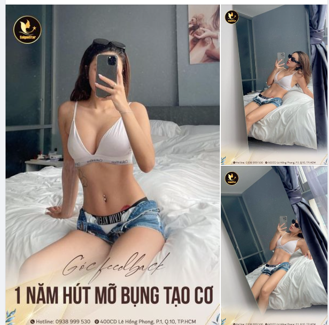 FEEDBACK SIÊU HOT SAU 1 NĂM HÚT MỠ BỤNG TẠO CƠ