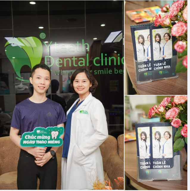 Niềng răng cùng Bác sĩ Hải Yến tại Nha khoa Yteeth