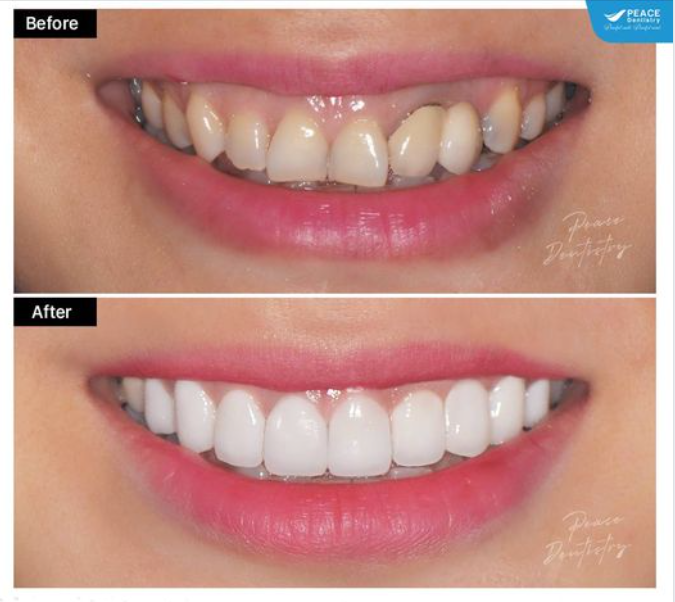 SMILE MAKEOVER | THAY ĐỔI DIỆN MẠO TỰ NHIÊN, VẪN LÀ CHÍNH MÌNH NHƯNG ĐẸP VÀ THU HÚT HƠN