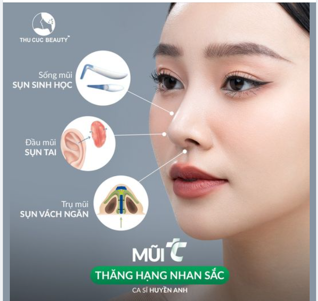 Tạm biệt sống mũi thấp, đầu mũi to với Mũi TC