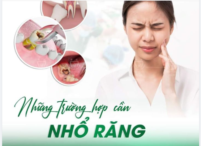 NHỮNG TRƯỜNG HỢP NÀO CẦN NHỔ RĂNG