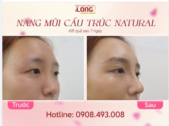 CHÀO TUẦN MỚI BẰNG MỘT DÁNG MŨI MỚI